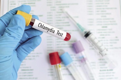 Chlamydia trachomatis