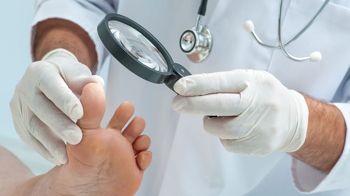 Cukorbetegek lábszövődményei: A diabéteszes lábproblémák megelőzése